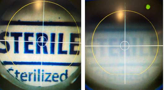 Side by side applanation view